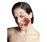 Infected false cheek