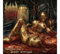 Infected Flesh - Concatenation of Severe..