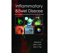 Inflammatory Bowel Disease: An Evidence-Based Practical Guide