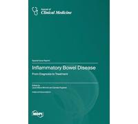 Inflammatory Bowel Disease: From Diagnosis to Treatment