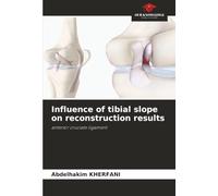 Influence of tibial slope on reconstruction results: anterior cruciate ligament