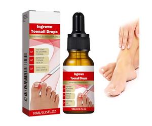Ingrown Toenail & Cuticle Support Oil - Helps Maintain Nail Health, Softens Thick Nails & Eases Discomfort