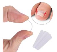 Ingrown Toenail Pedicure Tool 10pcs/bottle Straightening Clip Curved Bs Brace Toenails Thick Paronyc
