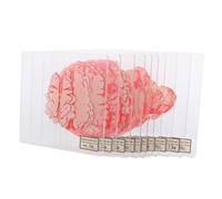 INOOMP 10pcs Acrylic Halloween Coasters Blood Spatter Brain Slice Design Drink Cup Mats for Party Table Decor Tea Cup Mats