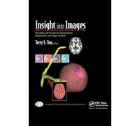 Insight into Images: Principles and Practice for Segmentation, Registration, and Image Analysis