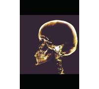 Insomnia: Prevention and Management