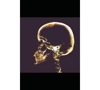 Insomnia: Prevention and Management