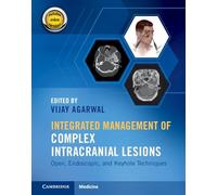 Integrated Management of Complex Intracranial Lesions Hardback Set and Static Online Product: Open, Endoscopic, and Keyhole Techniques