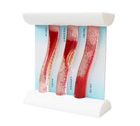 Interactive Dynamic Vascular Model, 3 Chinese Version
