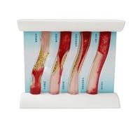 Interactive Dynamic Vascular Model, 4 Chinese Version