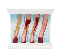 Interactive Dynamic Vascular Model, 4 English Versions