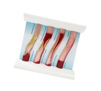 Interactive Human Vascular Systems Model Education Tool Design for Medicals Students to Study Blood Clots and Blockages Clinical Teaching Vascular Model
