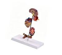 Interactive Medicals Teaching Tool Featuring Diabete Hypertensions Complications on Vital Organs Human Anatomy Model