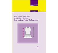 Interpreting Dental Radiographs: v. 1 (Quintessentials: Imaging)