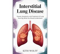 Interstitial Lung Disease: Causes, Symptoms, and Treatment of Lung Scarring: What You Should Understand