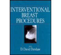 Interventional Breast Procedures