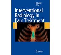 Interventional Radiology in Pain Treatment