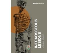 Intraosseous Lesions: Principles and Techniques at the Basis of Osteopathy