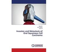 Invasion and Metastasis of Oral Squamous Cell Carcinoma