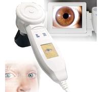 Iris Analyzer Camera with Pro Iris Software - 5.0MP USB Iridology Camera for Beauty Salons and Health Clubs