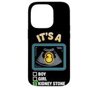 It's A Kidney Stone Gender Reveal Graphic Case for iPhone 14 Pro
