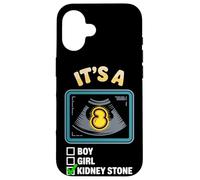 It's A Kidney Stone Gender Reveal Graphic Case for iPhone 16