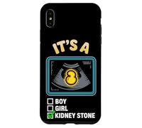 It's A Kidney Stone Gender Reveal Graphic Case for iPhone XS Max
