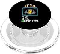 It's A Kidney Stone Gender Reveal Graphic PopSockets PopGrip for MagSafe