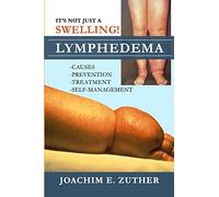 It's Not Just a Swelling! Lymphedema: Causes, Prevention, Treatment, Self-Management