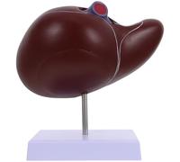 IWOWHERO Human Liver Anatomical Model Medical Teaching Display with Base, Enlarged Liver and Gallbladder Anatomy Model for School and Medical Training