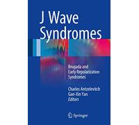 J Wave Syndromes: Brugada and Early Repolarization Syndromes