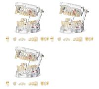 Jnchdghwa 3X Disease Teeth Model Dental Typodonts Implant Teeth Model with Removable Teeth Dentist Standard Tooth Demonstration