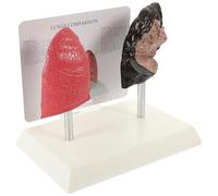 JOINPAYA Respiratory Lung Model 2Pcs Set Healthy Vs Smoking Lung Demonstration - Anatomical Display for Classroom and Training, Pulmonary Pathology Tool