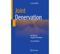 Joint Denervation : An Atlas of Surgical Techniques