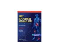 Joint Replacement Arthroplasty: Volume II: Hip, Knee, and Ankle: 2: Basic Science, Hip, Knee, and Ankle
