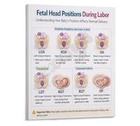 JRBJWYVV OB Labor Guide Poster Fetal Descent and Head Positions Chart for Students and Nurses Canvas Wall-Art(Unframed,16x24inch(40x60cm))