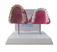 KDJFS Smokers Teeth Model and Healthy Teeth Model Life Size Human Tooth Anatomy Model with Pathological Features and Accurate Anatomy Structure for Emonstrate the Effects of Smoking on Tooth Health