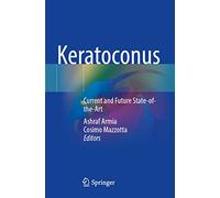 Keratoconus: Current and Future State-of-the-Art