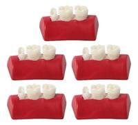 Keuyeo Dental Inlay Exercise Model 5pcs Typodont Resin Filling Exercise Model Teeth Training Model for Dentistry Teaching Study