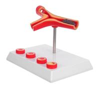 KICHOUSE Human Blood Vessel Model Plastic Anatomical Cardiovascular Teaching Supply Medical Pathology Demonstration Tool for Classroom and Diabetes Education