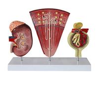Kidney Anatomical Model - human organ Anatomy model Human Renal Unit Model Glomerular Urinary System Model - for Medical EducationalAid