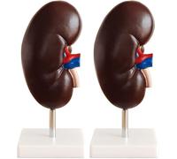 Kidney Anatomy Model - 4D Urinary Organ with Detachable Parts for Education