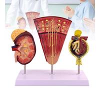 Kidney Model, Human Kidney Nephron and Glomerulus Model, Kidney Anatomy Model for Medical Education Assisted Dissection Suitable