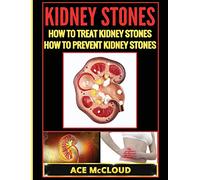 Kidney Stones: How To Treat Kidney Stones: How To Prevent Kidney Stones (Kidney Stone Treatment & Prevention Guide with All)