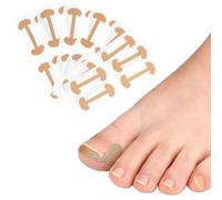 KIRZAX 100pcs Set Toenail Correction Set, Incarnate Nail Lifter, Elastic Cotton Nail Stickers, Toe Stickers, Pedicure Toenail Toenail Treatment Tool Kit
