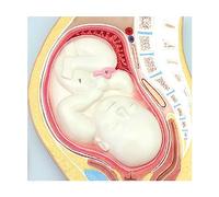 KJMWXOP Educational Materials, Organ Model, Human Pregnancy, Embryonic Process, Fertilized Egg, Uterine Tissue, Rotation Detachable For Training Aid
