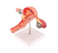 KMHHAG Uterus Anatomical Model Pvc Female Human Life-Size Pathological Reproductive System With Ovaries Medical School Education Teaching Tool