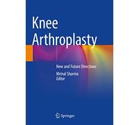 Knee Arthroplasty: New and Future Directions