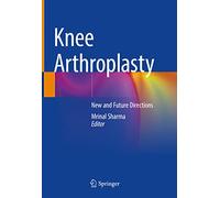 Knee Arthroplasty: New and Future Directions