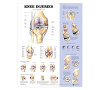 Knee Injuries Anatomical Chart